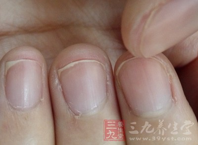 得甲沟炎的原因 指甲剪得太短会诱发甲沟炎