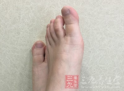 萬一發(fā)生腳部燙傷，首先不要驚慌