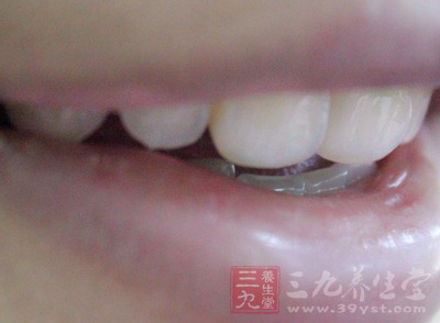 白天小憩，梦境中的牙齿脱落，无血之兆的深层解析