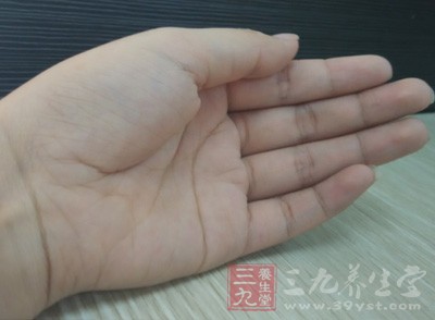 有的人掌心有一条由两根粗大的横向皱纹合起来的所谓四指横向纹路