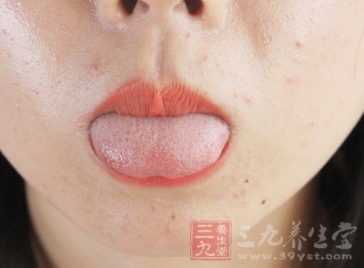 若发现舌头过于平滑、味蕾突起发红 若发现舌头过于平滑、味蕾突起发红
