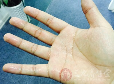 遇到手心发热这种症状，一定不要情绪过多紧张