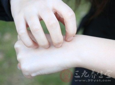 手肿是什么原因 这些原因导致你的手部肿大 - 