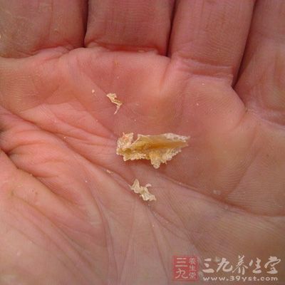 耳屎多是怎么回事 耳屎看身体被污染程度