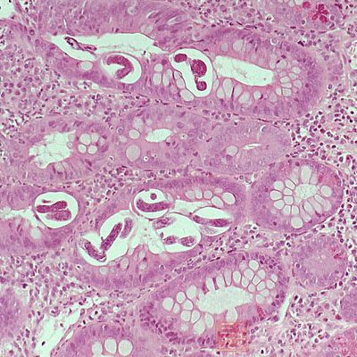 什么是黑色素瘤是癌症吗 1428383942312.jpg