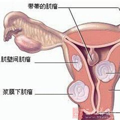 人口增长 指望 子宫(2)