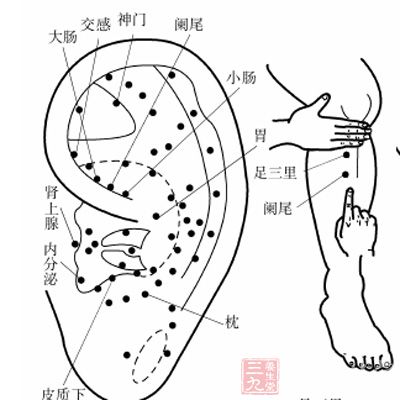 慢性阑尾炎 阑尾炎治疗和预防方法