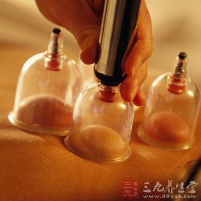 拔火罐的好处 正确拔罐好好多多