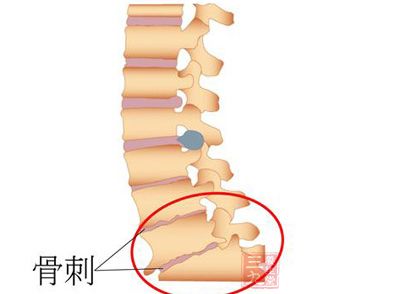 成语什么剌骨_成语故事图片(3)