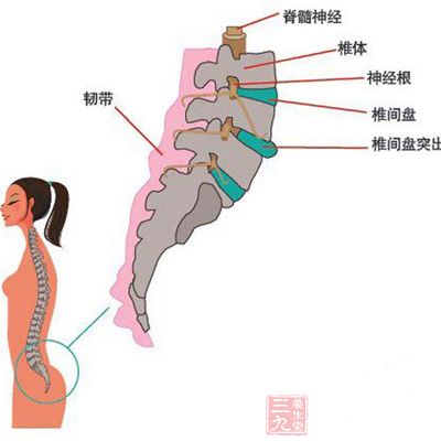 腰肌劳损能治好吗