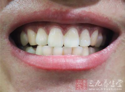 如何刷牙防止牙齿蛀牙 1454038178147.jpg