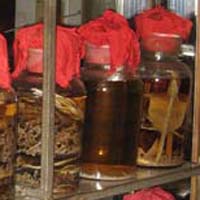 治疗山瘴疟的常山药酒方