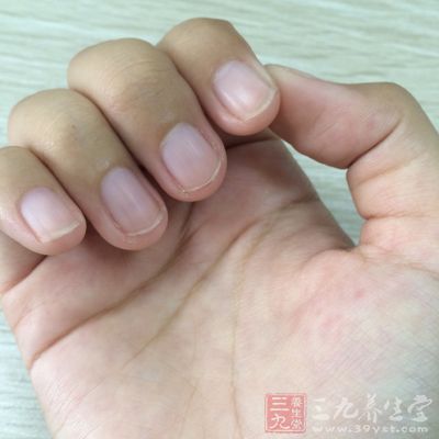 如遗传性疾病,肝硬化,严重贫血,营养不良等