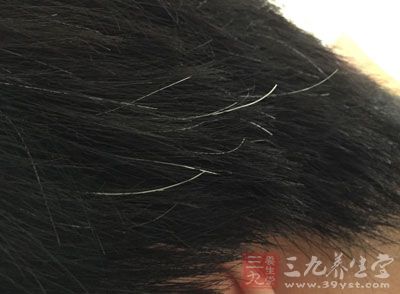 白头发能变黑吗 1461123356780.jpg