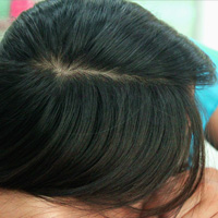 第七十一章 流产先兆