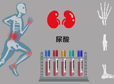 考虑尿酸升高原因，需要从内源性、外源性方面考虑