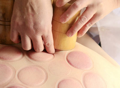 皮膚過敏、破潰、有出血傾向的人群，以及孕婦、經(jīng)期女性等，不適合拔罐減肥