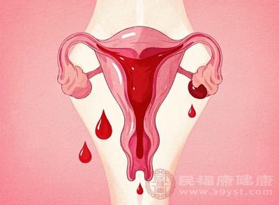 如果每次經(jīng)期都有大量血塊，且持續(xù)3天以上，甚至整個(gè)經(jīng)期血塊不斷，可能是子宮內(nèi)膜增厚、子宮肌瘤等問(wèn)題的表現(xiàn)