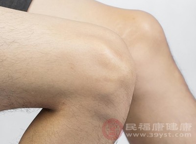 水腫腿的腿部皮膚按壓后會(huì)出現(xiàn)凹陷，且恢復(fù)速度較慢，早晨起床時(shí)腿部看起來相對(duì)纖細(xì)，到了晚上則明顯腫脹