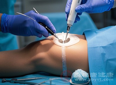 吸脂真的能瘦成閃電嗎 真相在這速看