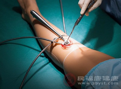 吸脂手術不僅能減少脂肪，還能在一定程度上改善皮膚松弛問題