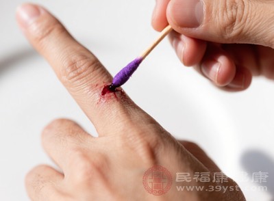 紫藥水最突出的功效便是強(qiáng)大的抗菌殺菌能力，堪稱傷口抵御病菌的“防護(hù)盾”
