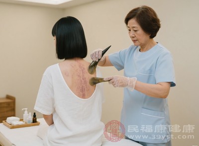 在刮痧過程中或刮痧后，部分人可能會出現(xiàn)頭暈、心慌、惡心、乏力等不適癥狀，這種現(xiàn)象被稱為“暈刮”