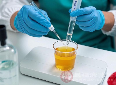尿酸本身在尿液中濃度過高時(shí)，也可能讓尿液呈現(xiàn)偏深的顏色，尤其在飲水不足、尿液濃縮時(shí)，這種顏色變化會(huì)更明顯