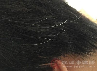 30歲前白發(fā)占比超過(guò)頭發(fā)總量的10%，可能存在病理性因素，需到醫(yī)院皮膚科或內(nèi)分泌科就診