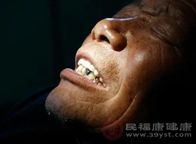 如果長(zhǎng)期不刷牙、不使用牙線清潔牙縫，或者刷牙方法不正確，沒(méi)有徹底清潔牙齒和口腔黏膜，就容易出現(xiàn)這種情況
