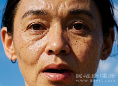 皮膚老化：老人斑形成的基礎(chǔ)