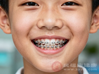 牙齿整形是一个相对漫长的过程,一般需要1-3年 牙齿整形是一个相对漫长的过程,一般需要1-3年