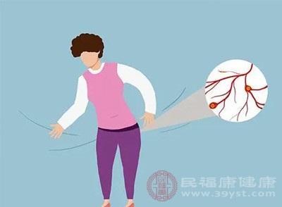 按摩特定穴位也有助于缓解外痔症状 按摩特定穴位也有助于缓解外痔症状