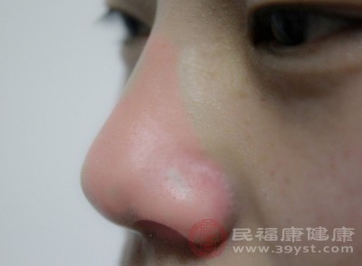 糖尿病患者長期血糖控制不佳，會(huì)引發(fā)周圍神經(jīng)病變，累及嗅神經(jīng)，影響嗅覺傳導(dǎo)