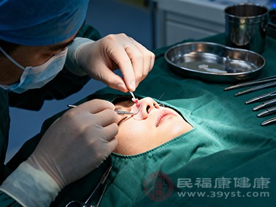 自体软骨隆鼻常用的材料有耳软骨、鼻中隔软骨和肋软骨 自体软骨隆鼻常用的材料有耳软骨、鼻中隔软骨和肋软骨