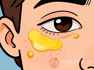 女性膽固醇升高 身體會(huì)發(fā)出這些“求救信號(hào)” 女性膽固醇升高 身體會(huì)發(fā)出這些“求救信號(hào)”