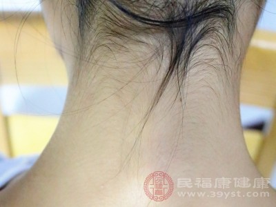 颈椎闹脾气 这些信号可能在疯狂求救 颈椎闹脾气 这些信号可能在疯狂求救