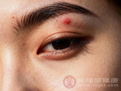 劣质的眉部化妆品，容易刺激皮肤，引发过敏和炎症反应