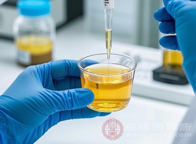 女性经期前后,经血混入尿液,很容易干扰检测结果 女性经期前后,经血混入尿液,很容易干扰检测结果