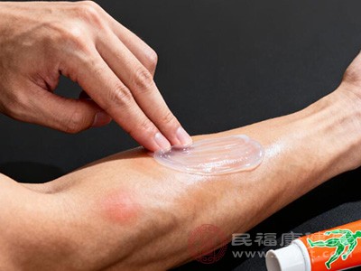 外用药物能直接作用于疼痛部位,使用方便且副作用较小 外用药物能直接作用于疼痛部位,使用方便且副作用较小