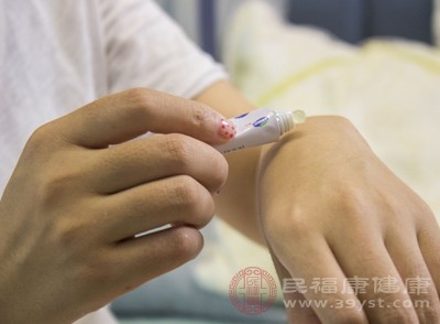 止痒的外用药物