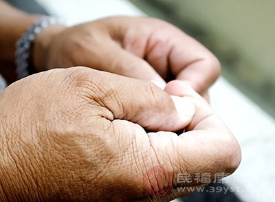 指甲竖纹别瞎猜 真相都在这里啦