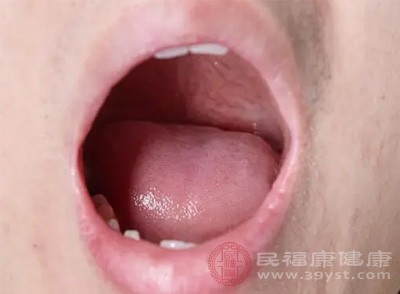 观察舌苔也是判断湿热下注的重要方法