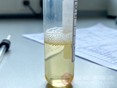 除了肾脏和泌尿系统疾病，一些全身性疾病也可能间接导致小便泡沫多