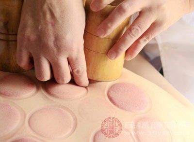 別慌 拔罐出水泡不是“排毒” 這些原因和應(yīng)對法要知道 別慌 拔罐出水泡不是“排毒” 這些原因和應(yīng)對法要知道