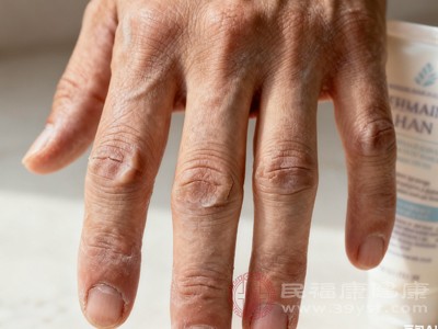 秋冬手开裂疼到出血 这些诱因你可能天天碰 防护要点记好