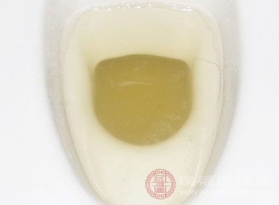 如果發(fā)現(xiàn)尿液表面漂浮著一層細小的泡沫，且久久不消散，這可能是蛋白尿的表現(xiàn)