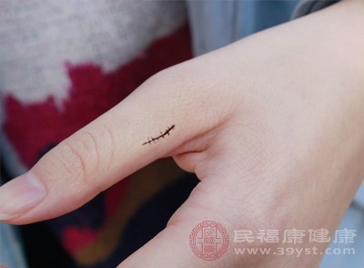 要密切观察伤口的愈合情况