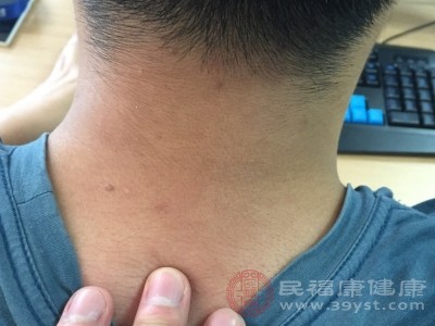 大椎穴被艾条“拿捏”后 身体竟悄悄发生这些变化