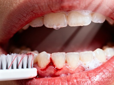 牙齿排列不齐、牙缝过大，易堆积食物残渣和牙菌斑，也会增加牙龈出血的风险